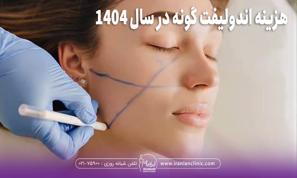 صورت دختری که پزشک با ماژیک روی صورت او خطوطی را ترسیم می کند و روی عکس نوشته شده "هزینه اندولیفت گونه در سال 1404"