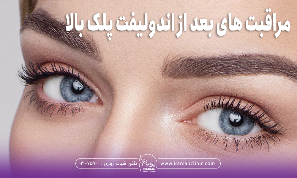 عکس از چشم و ابروی دختر جوان با چشمان آبی که روی عکس او نوشته شده "مراقبت های بعد از اندولیفت پلک بالا"