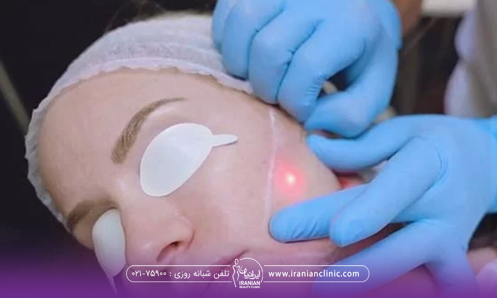 خانمی که عینک مخصوص به چشم هایش زده است و دست دکتری که در حال انجام اندولیفت روی صورت او است