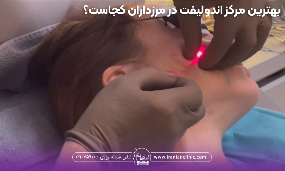 دستان دکتری که در حال انجام اندولیفت روی صورت فرد است