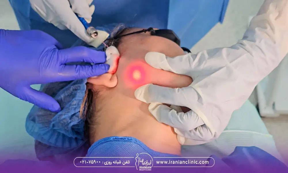 اندولیفت فک برای چه کسانی مناسب 