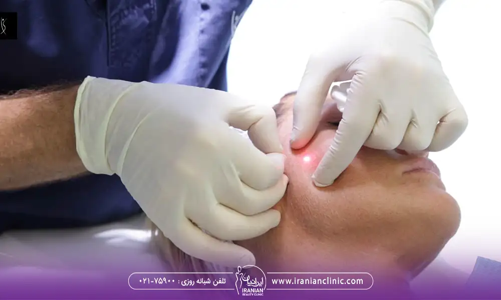 اندولیفت برای چه کسانی مناسب
