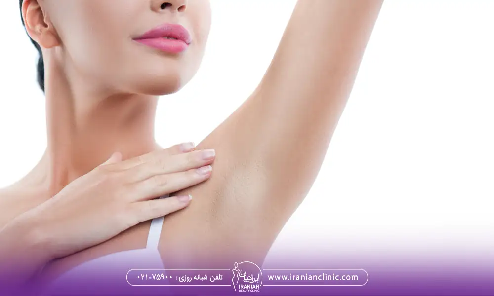 خانمی با زیر بغل لیفت شده و سفید بعد از اندولیفت زیر بغل