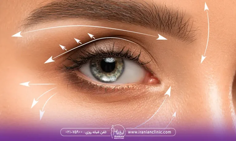نمایش نحوه افتادگی پوست