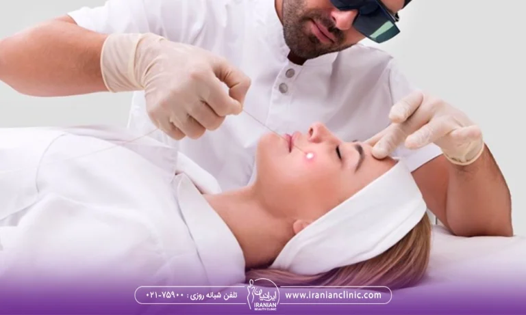 مزایای اندولیفت را بدانید!