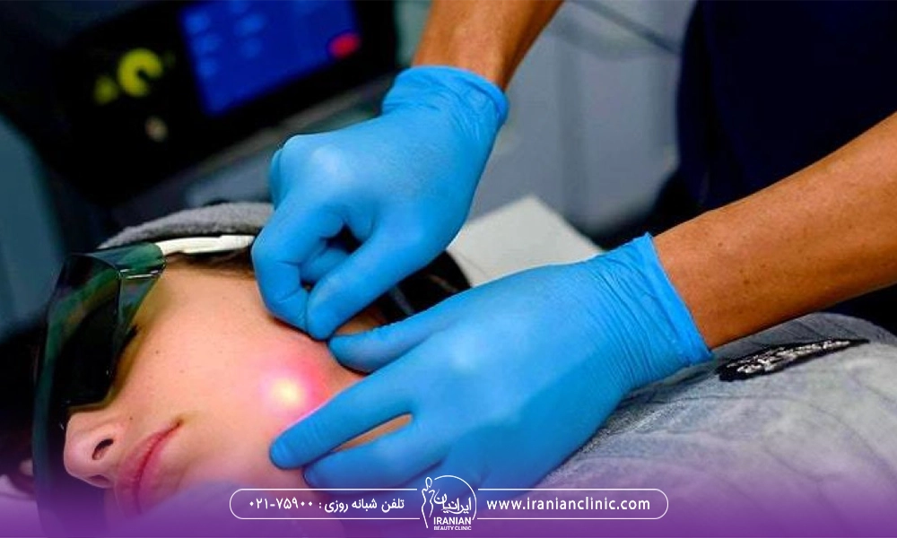 تاثیر عملکرد دستگاه اندولیفت رو پوست صورت