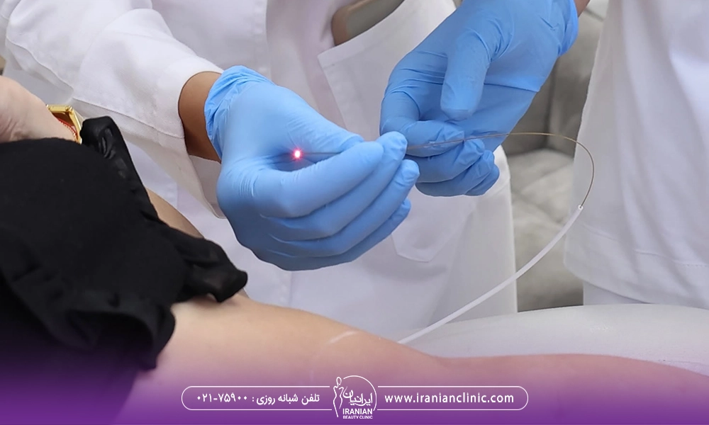 عکس هندپیس دستگاه اندولیفت و بی حسی بعد از اندولیفت