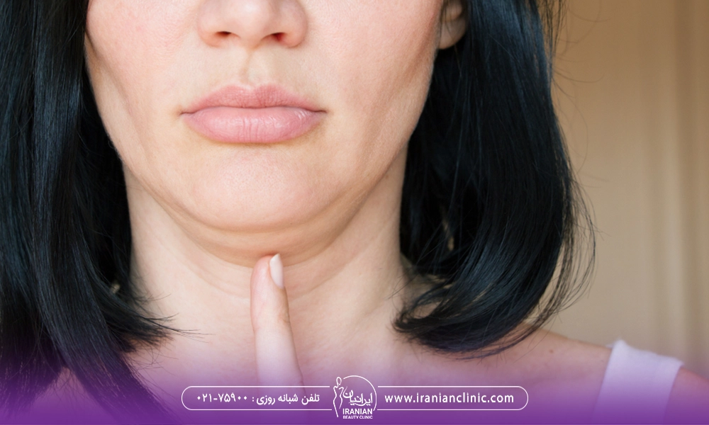 اشاره خانمی به غبغب هود برای از بین بردن غبغب